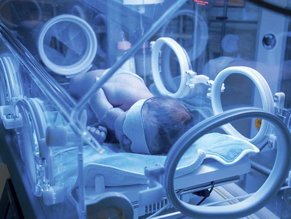 PReterm Baby in an incubator