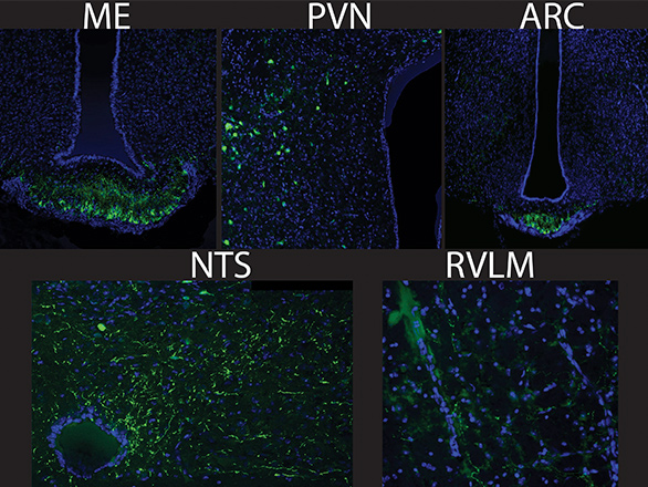 Microscpoic image of PVN-TH-Cre-10x-TIT2L-eGFP