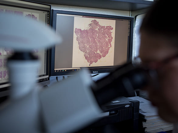 A med student looks into a microscope with the display on monitor in the background